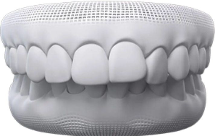 invisalign before after