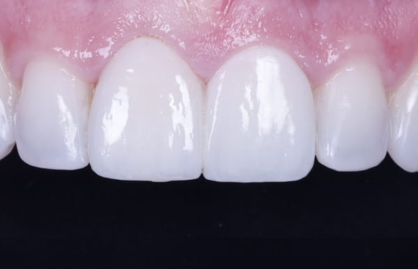 face - haymarketdentalnew