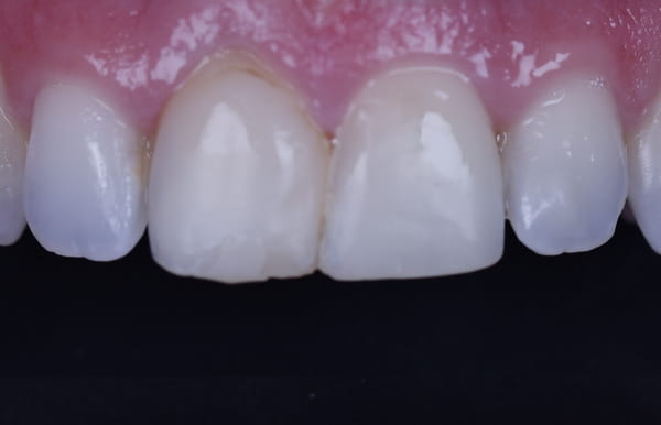 face - haymarketdentalnew