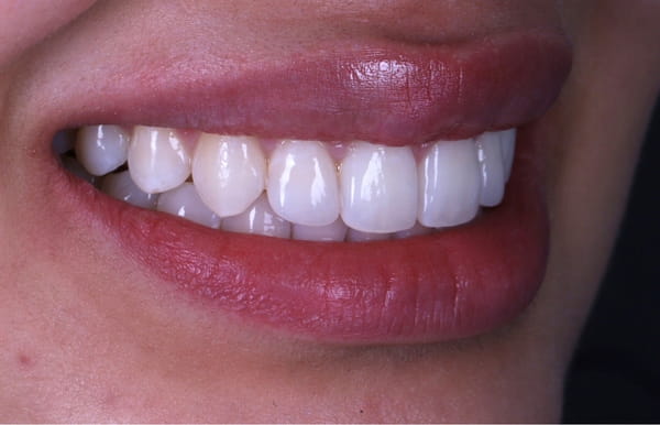 face - haymarketdentalnew