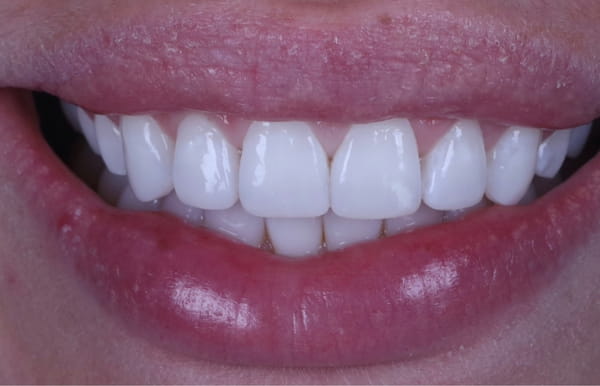 face - haymarketdentalnew