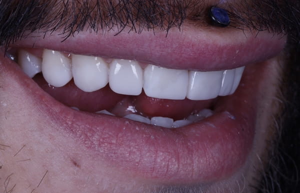 face - haymarketdentalnew