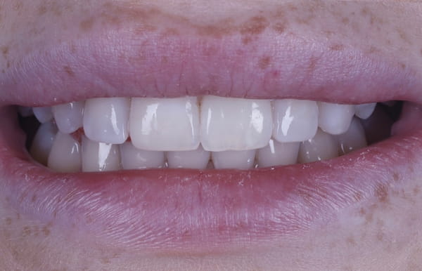 face - haymarketdentalnew