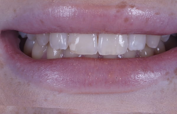 face - haymarketdentalnew