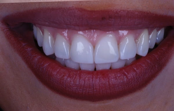 face - haymarketdentalnew