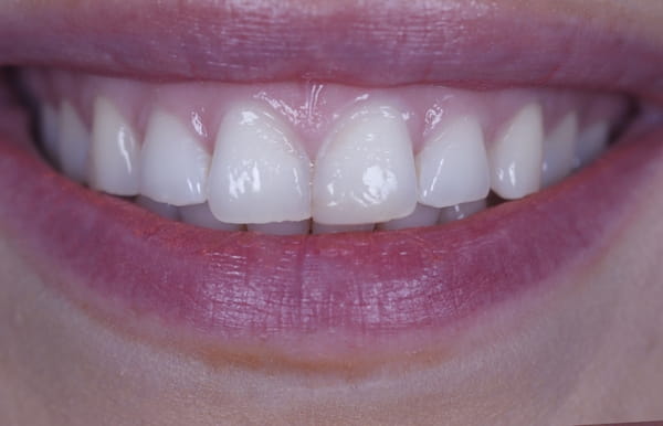 face - haymarketdentalnew