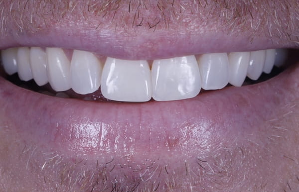 face - haymarketdentalnew