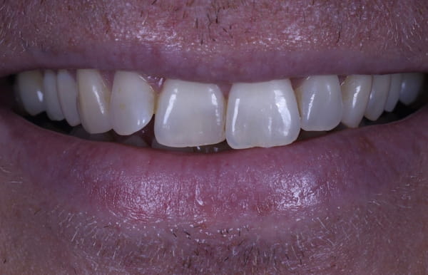 face - haymarketdentalnew