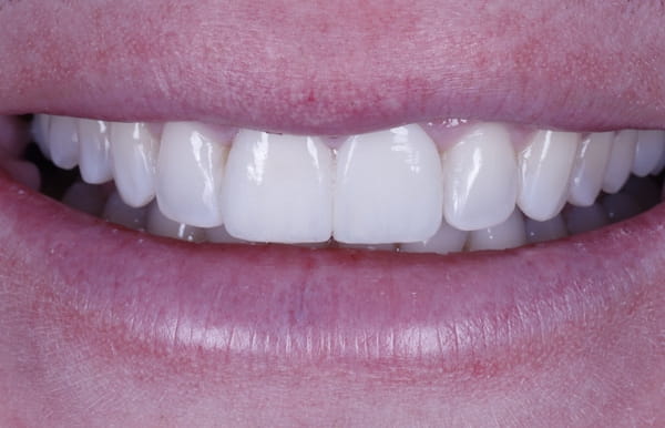 face - haymarketdentalnew