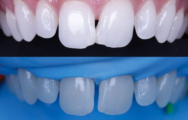 face - haymarketdentalnew