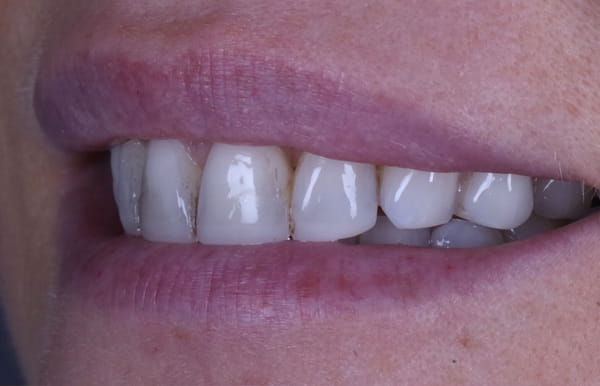 face - haymarketdentalnew