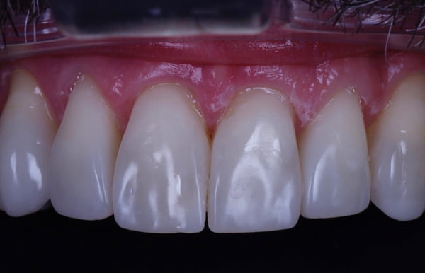 face - haymarketdentalnew