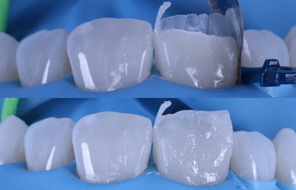 face - haymarketdentalnew