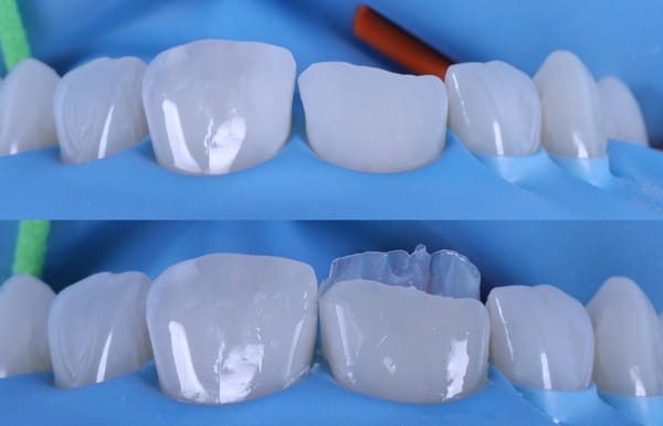 face - haymarketdentalnew