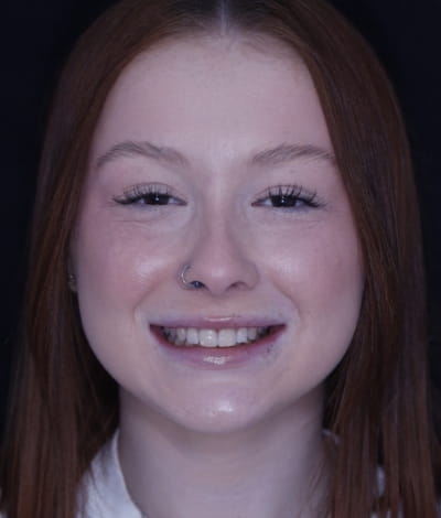 face - haymarketdentalnew