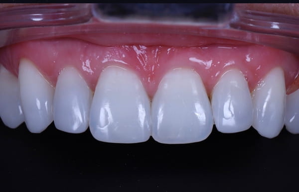 face - haymarketdentalnew