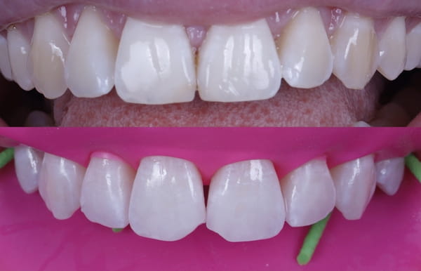 face - haymarketdentalnew