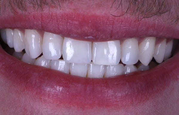 face - haymarketdentalnew