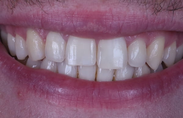 face - haymarketdentalnew