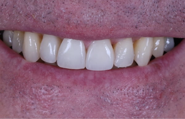 face - haymarketdentalnew