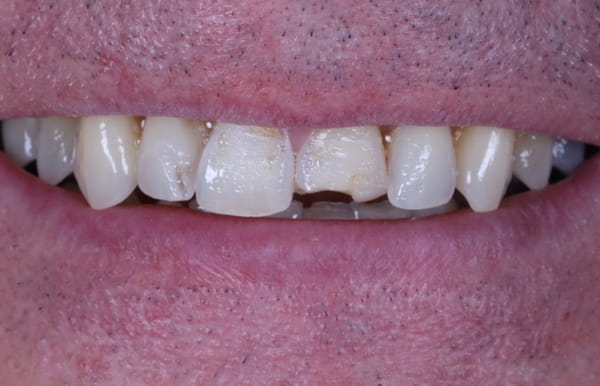 face - haymarketdentalnew
