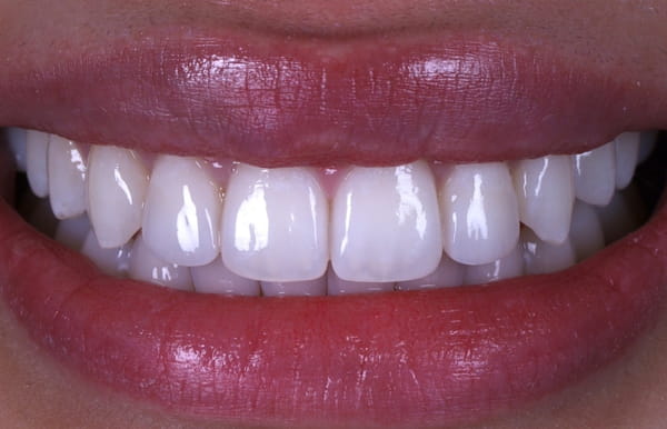 face - haymarketdentalnew