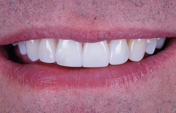 face - haymarketdentalnew
