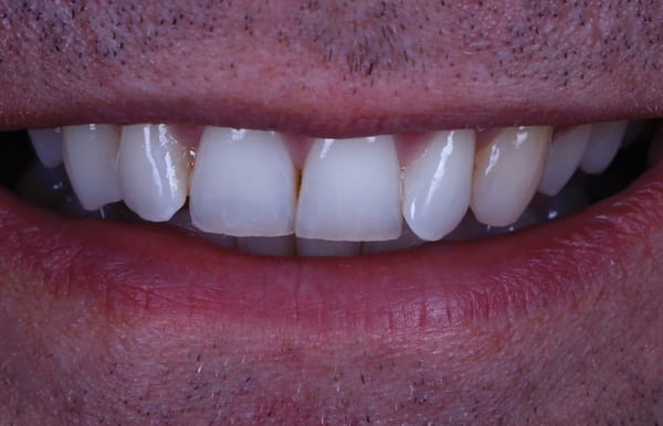 face - haymarketdentalnew